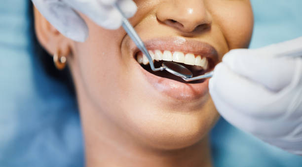 Best Emergency Denture Repair in Centerville, OH